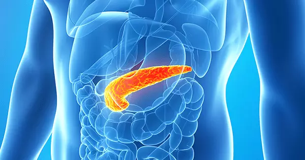 Pankreas Kanseri: Agresif Ama Mücadele Edilebilir