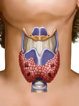 Tiroid, Paratiroid ve Sürrenal Bezin Kanserleri